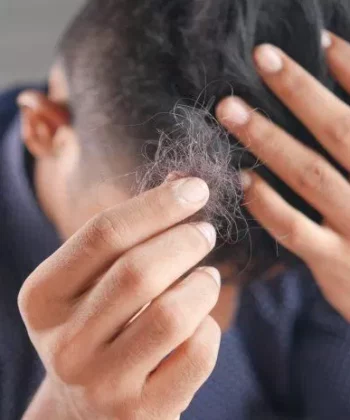 Rụng tóc đang làm bạn lo lắng mỗi ngày. (Nguồn: Internet)