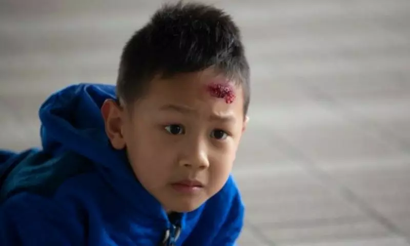 Trẻ bị ngã chảy máu đầu có nguy hiểm không. (Ảnh: Nguồn Internet)