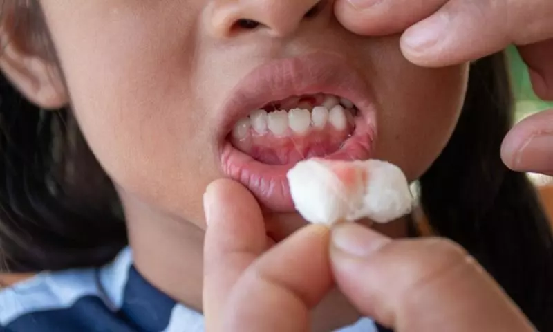 Trẻ bị ngã chảy máu răng cần làm gì? (Ảnh: Nguồn Internet)