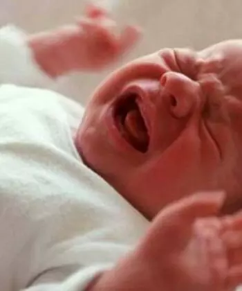 Những nguyên nhân khiến trẻ sơ sinh bị bỏng môi, lưỡi (Nguồn: Sưu tầm Internet)